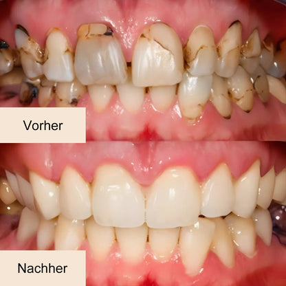 LBMLBM™ Nano-Hydroxyapatit Deep-Fusion Drops
