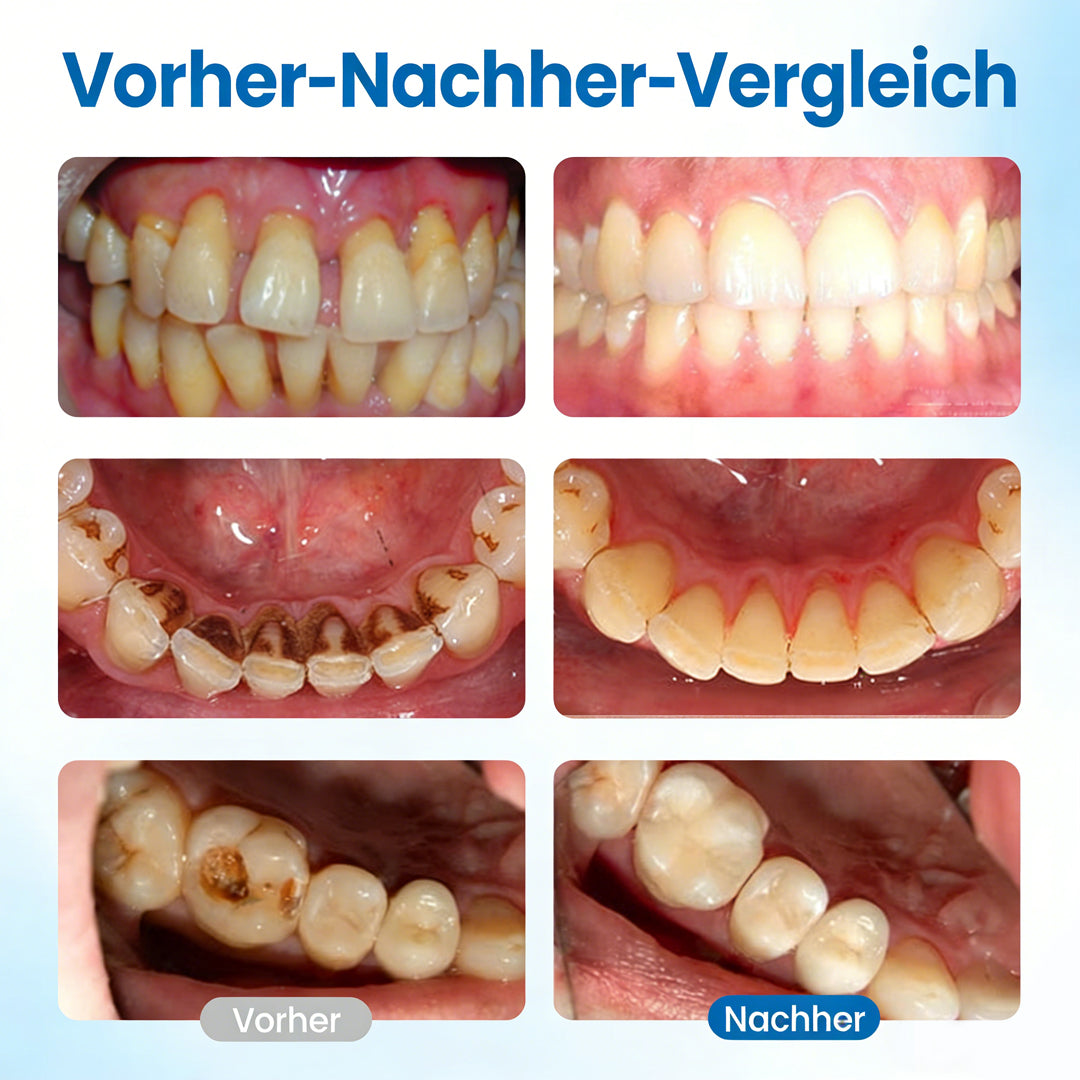 LBMLBM™ NanoHAP Zahnschutz-Serum