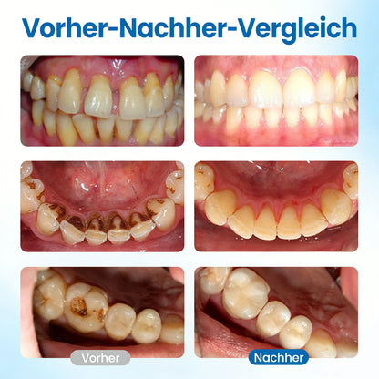 LBMLBM™ NanoHAP Zahnschutz-Serum