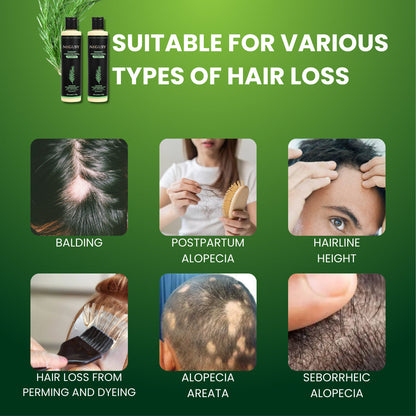 🌿 NEGUSY Rosmarin Keratin Reparatur-Shampoo für dickeres, stärkeres Haar — 🔥Reduziert Haarbruch & spare bis zu 40 % heute!