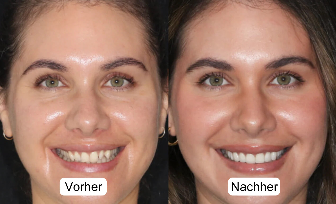 LBMLBM™ Nano-Hydroxyapatit Deep-Fusion Drops